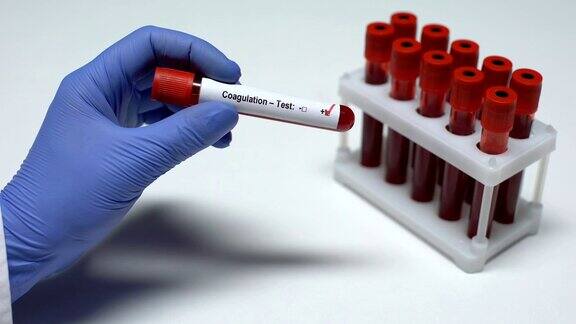凝血试验阳性医生管中有血样健康检查