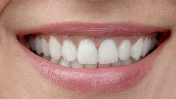 一个迷人的女孩的微笑与完美的白牙齿近完美的白牙齿和微笑