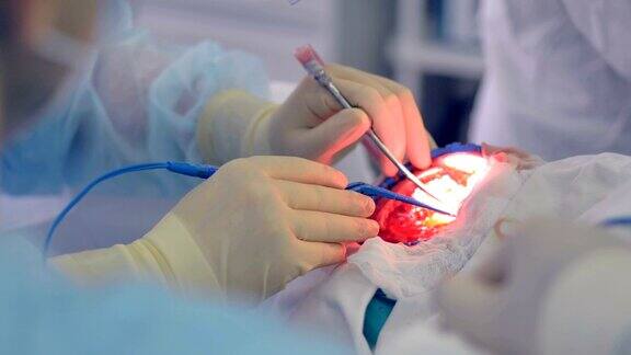 外科医生在操作病人的颅骨时手持锋利的工具