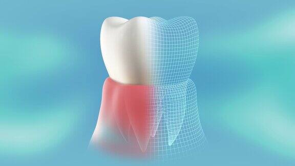 一个健康治愈的牙齿在牙龈介绍360度旋转和停止循环