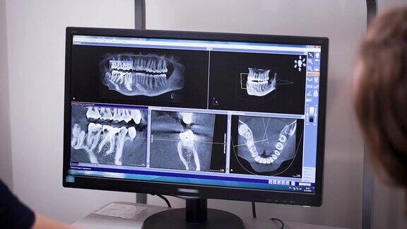 牙科医生和正畸医生在监视器上观察病人的牙齿和颌部的x光片