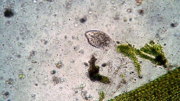 微群落显微镜下的纤毛虫刺齿菌的生命活动