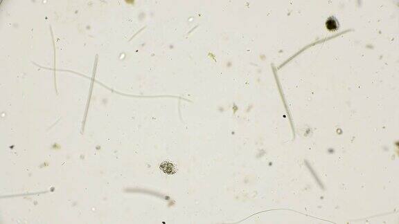 在显微镜下观察水母CAENOMORPHAMEDUSULA微生物