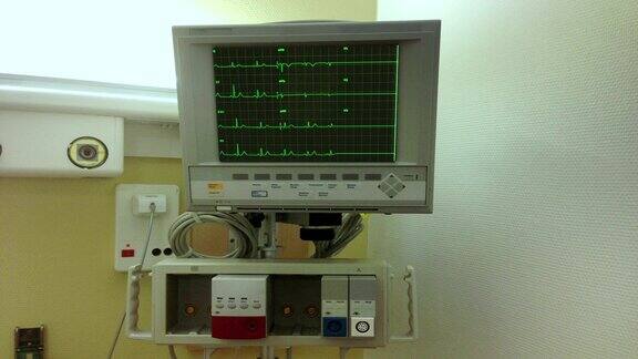 心电图显示心脏停止跳动