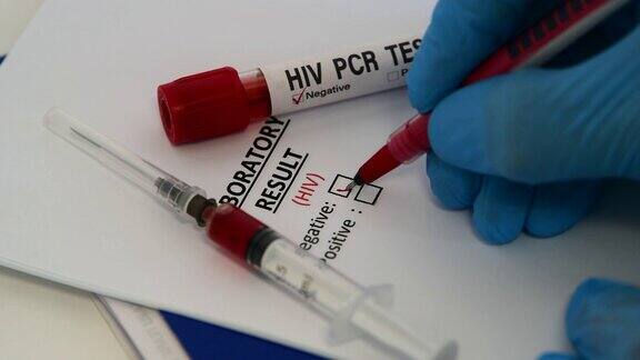 艾滋病病毒测试艾滋病血液测试