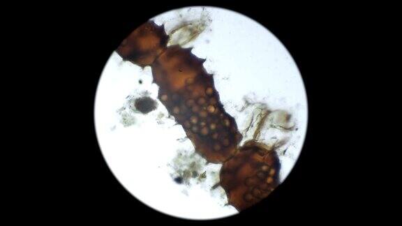 在显微镜下观察被保护壳中的微生物卵