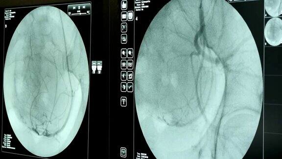 现代x光设备检查病人的心血管系统