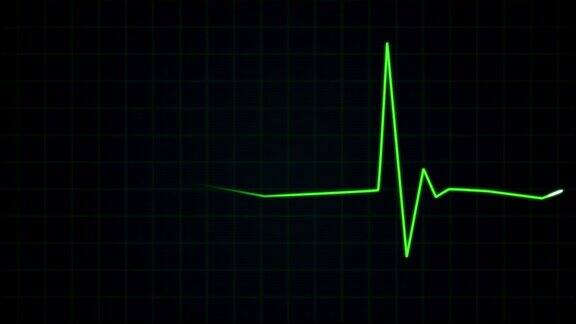 心电图心脏监护仪显示持平