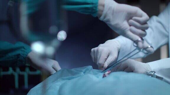 手术手在手术室带手套的手持手术工具