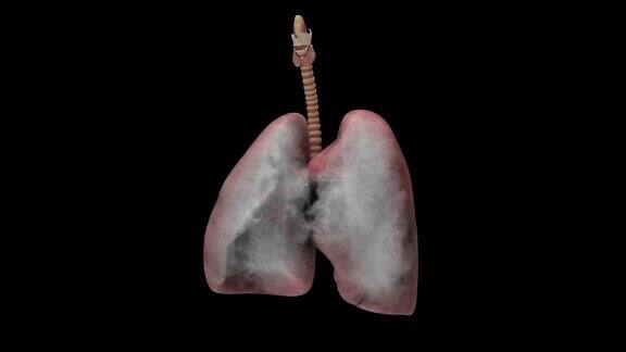 吸烟对肺部的影响