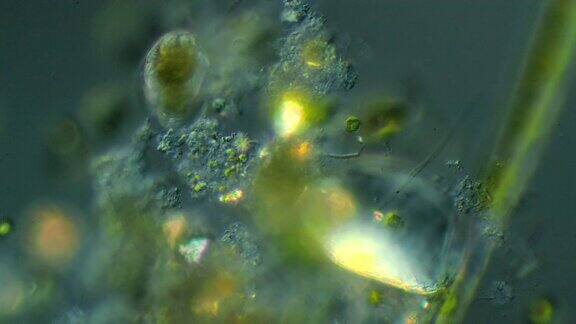 显微镜的Cephalodella