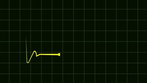 4k动画HUD心率心电图医疗监视器股票视频-红蓝黑白黑绿色