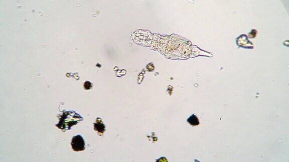 显微镜下显微镜下池塘中一滴水中的微小轮虫