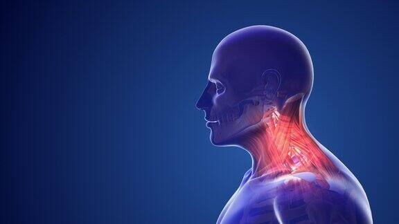 颈椎体位综合征或颈部疼痛