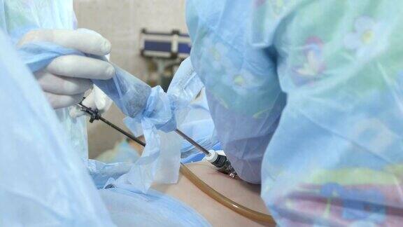 外科医生进行腹腔镜手术