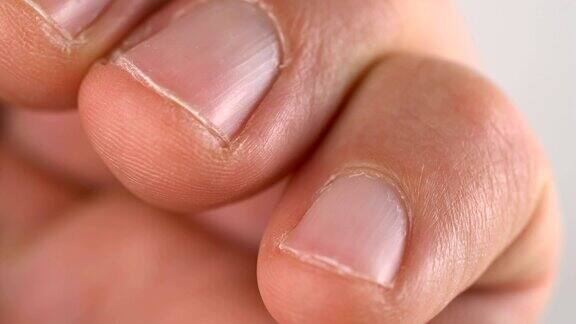 男人手指上的指甲