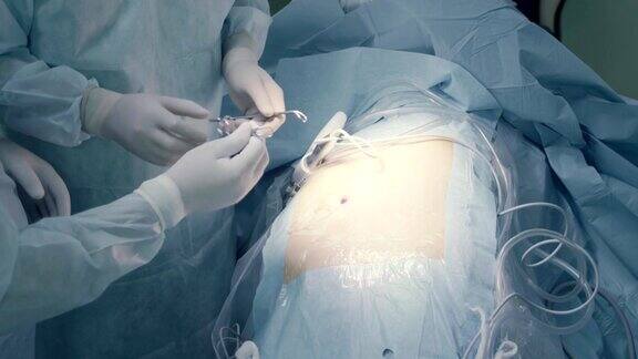 腹腔镜手术前的腹部