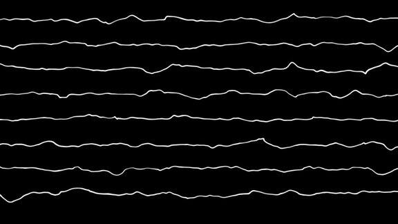 一个声音信号的动画白色的波浪均衡器在黑色的背景