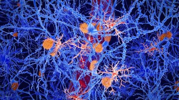 小胶质细胞(红色)在阿尔茨海默病的发病机制中起着重要的作用
