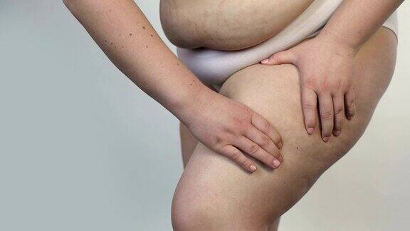 肚子上有妊娠纹胖女人摸腿脂肪团