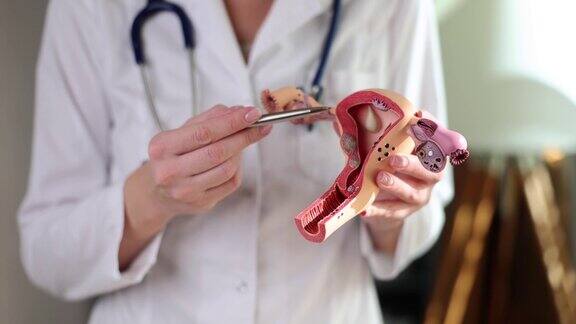 妇科医生展示子宫和卵巢的解剖模型和病理特写