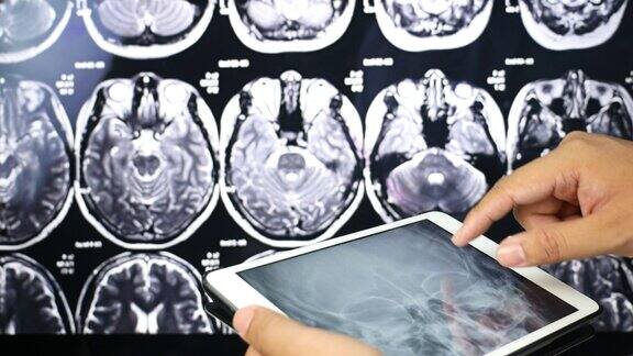 医生使用数字平板检查颅骨x射线扫描医疗保健和医学概念