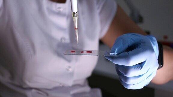 女实验室技术员将血滴在玻片上特写镜头是双手