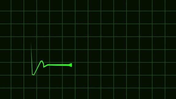 4k动画HUD心率心电图医疗监视器股票视频-红蓝黑白黑绿色