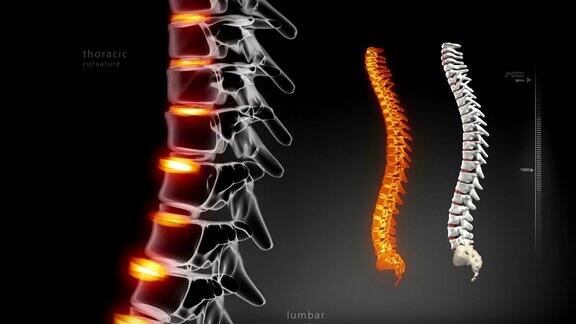 人体脊柱医学扫描