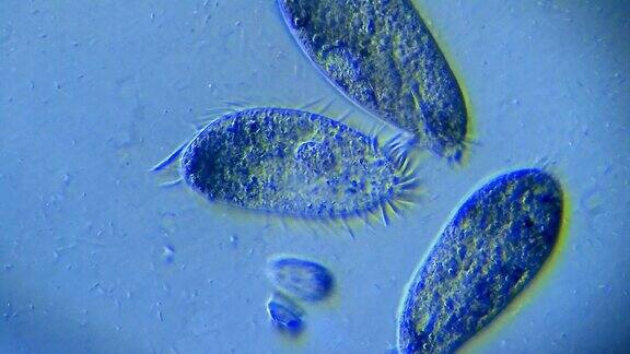 微型生物纤毛虫