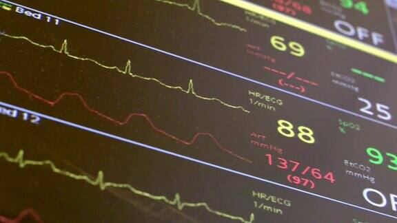 显示几个病人参数的急诊室心脏监护仪