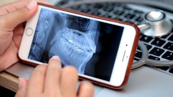 医生在智能手机上看x光片