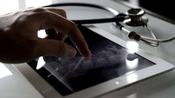 医生在平板电脑上检查x射线图像