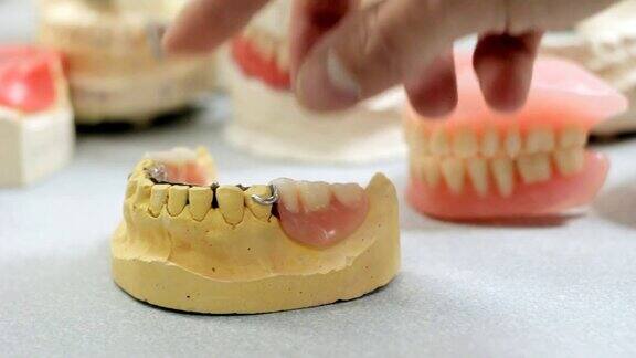 在牙科实验室里医生根据颌骨模型检查假牙