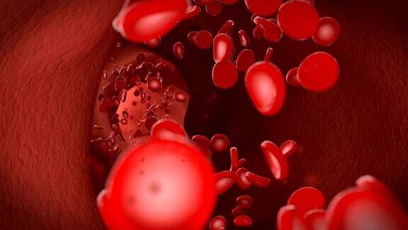 红细胞红细胞在静脉中流动