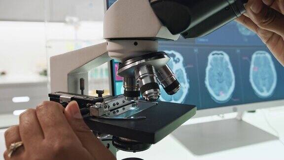 拿着显微镜的女科学家亲密的ups电脑屏幕上的脑电波扫描研究