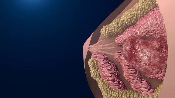 乳腺癌细胞生长动画