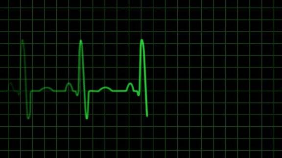 心电图心电图脉搏描记心脏监护仪