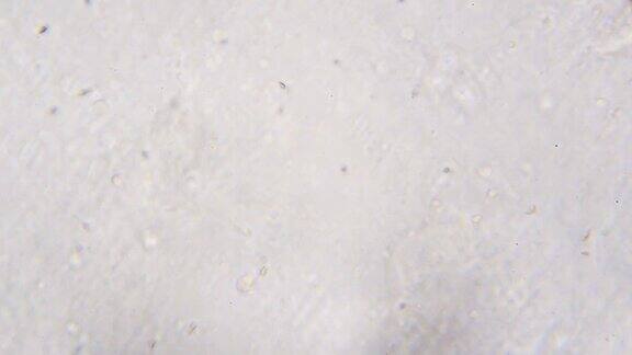 活体精子(精子运动)在显微镜下