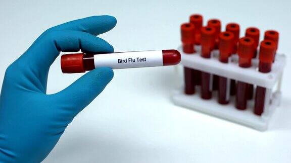 禽流感测试医生出示血液样本实验室研究健康检查