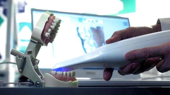 手动3D扫描牙齿医生扫描了下巴上的一组牙齿牙医检查牙齿牙科的新技术