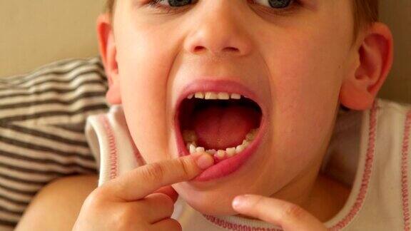 小男孩正在掉第一颗乳牙