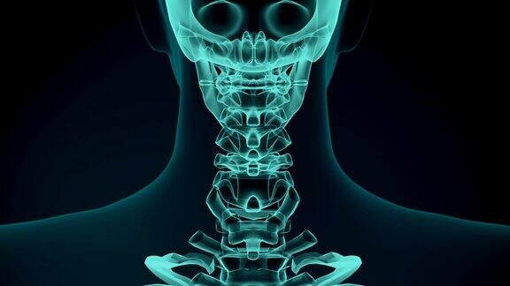 疼痛的脖子的3d渲染图医学概念动画