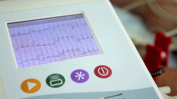 心电图、心电监护仪