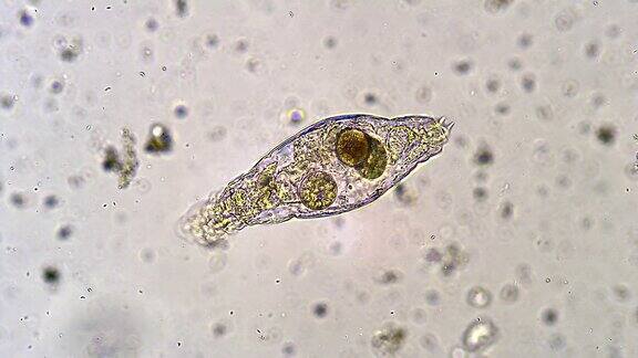 在死轮虫体内漂浮的微生物纤毛虫