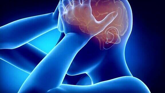 偏头痛伴有搏动性疼痛