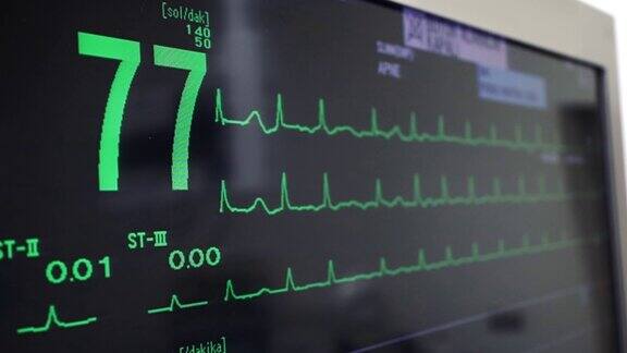 手术中的心脏体征筛选病人的心生命体征监测心电图股票视频