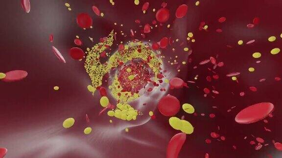 血管:红细胞胆固醇和血小板