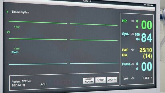 医院的心电图病人心脏监护仪