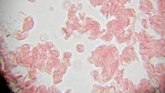 1000倍显微镜下看到的新鲜血液显微镜下的血液涂片显示血浆、白细胞和红细胞